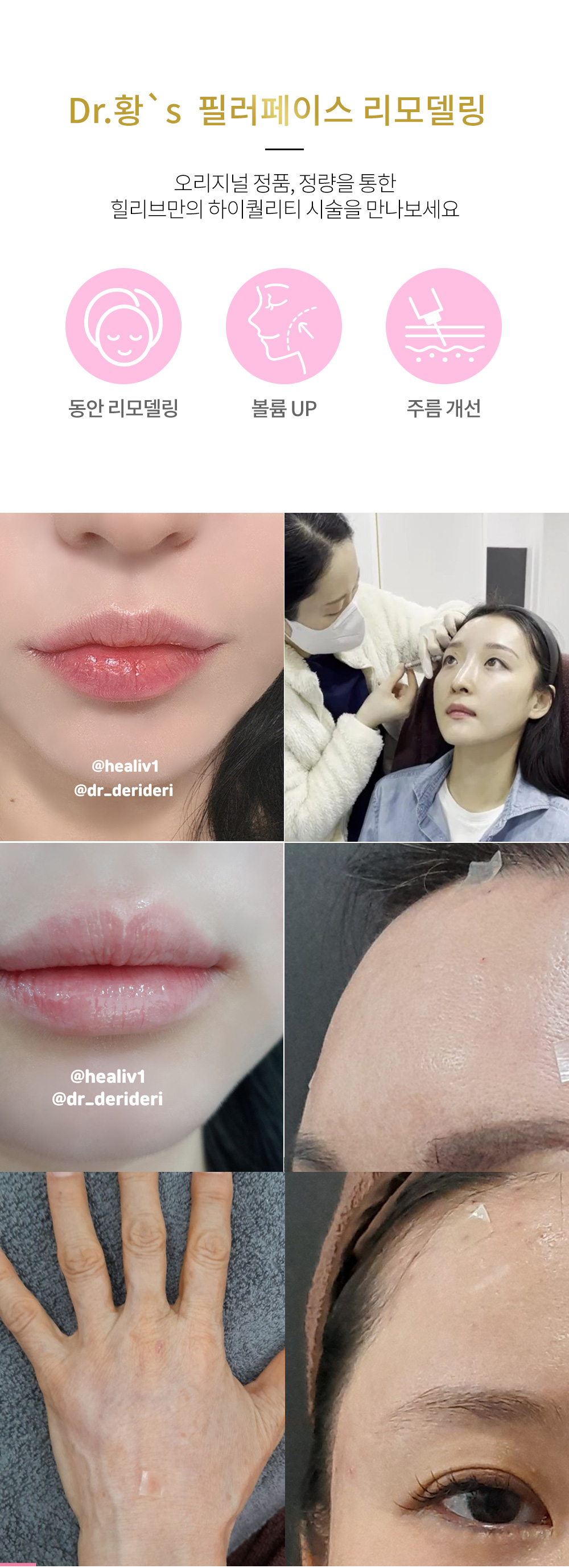 필러_FILLER 힐리브의원