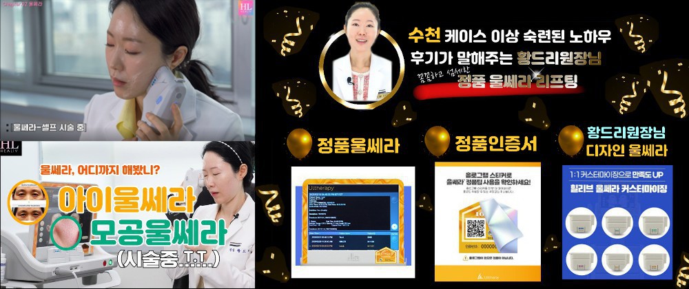 울쎄라 디자인 리프팅